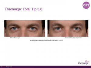 Thermage Total Tip Sales Presentation-Page-18